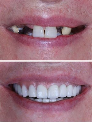Smile Transformations