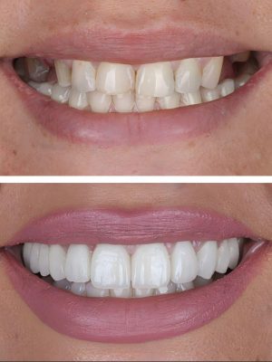 Smile Transformations