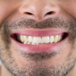 Close-up of man showing his teeth