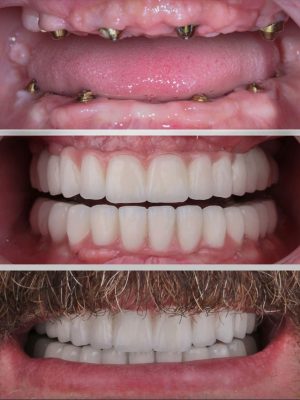 Smile Transformations